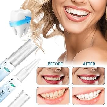 SmilePen Pro™ –  Blanquea tus dientes con tecnología profesional, desde casa 🦷✨+ Envio Gratis